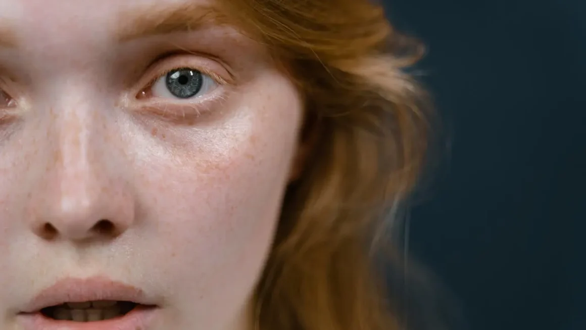 Czy kwas hialuronowy powoduje zaskórniki? Zobacz, czy zapycha skórę!